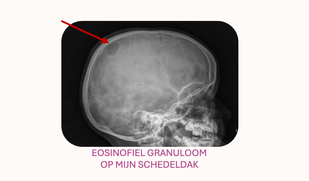 1987 – DE&nbsp;OPERATIE