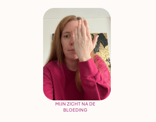 2024 – MIJN&nbsp;HERSENBLOEDING