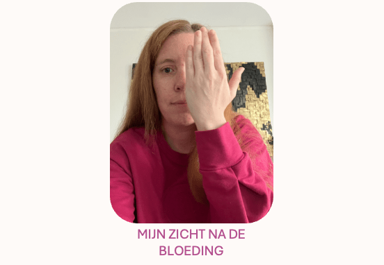2024 – MIJN&nbsp;HERSENBLOEDING